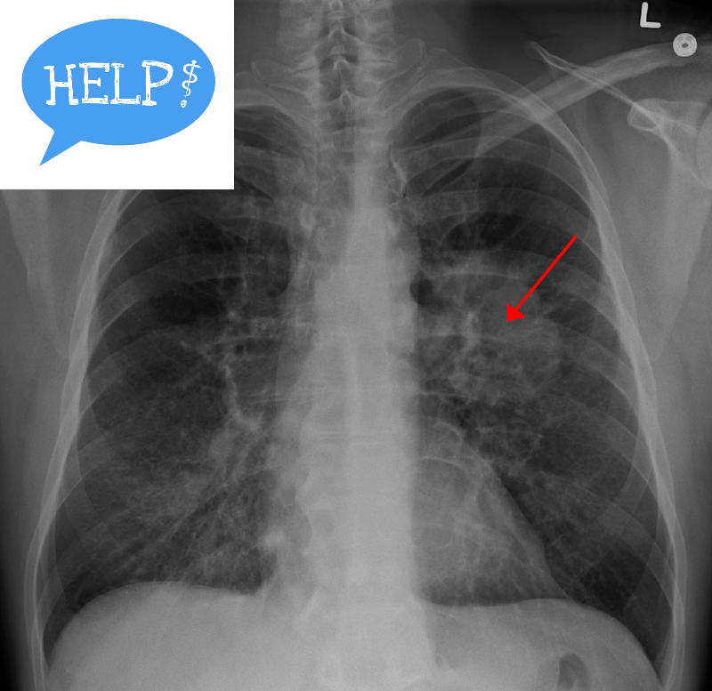 MODULE 8 BASIC DISEASES